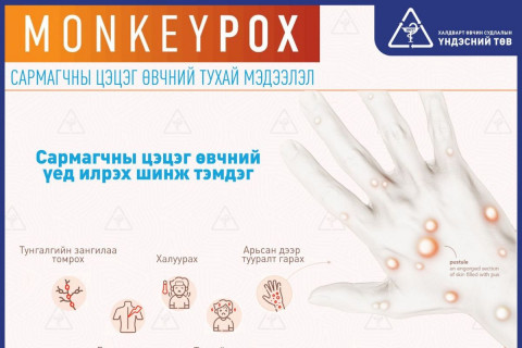 Сармагчны цэцэг өвчний нууц үе 5-21 хоног байдаг тул шинж тэмдэг илэрч байх үед халдварыг бусдад тараах эрсдэлтэй