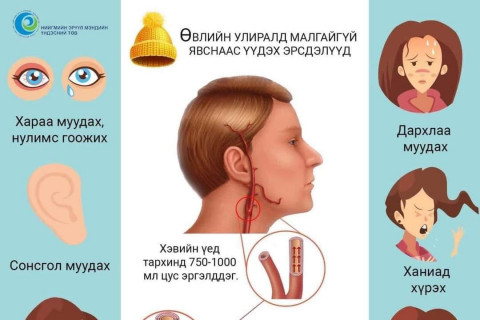 Өвлийн улиралд малгай өмсөхгүй байх нь сонсгол муудахад нөлөөлнө